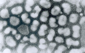 Grippe H1N1 : la pandémie est officiellement terminée