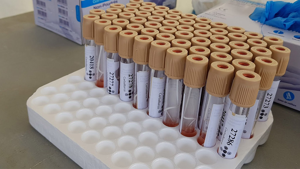 2 nouveaux cas confirmés de coronavirus à La Réunion ce mardi, dont 1 autochtone
