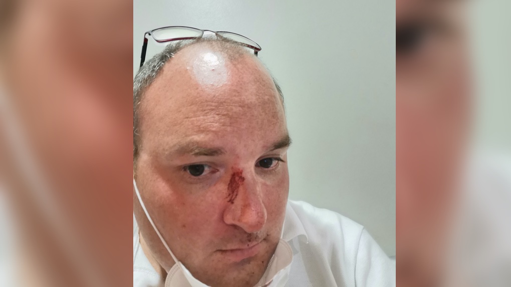 St-André : Un chauffeur de bus agressé pour la deuxième fois en un an