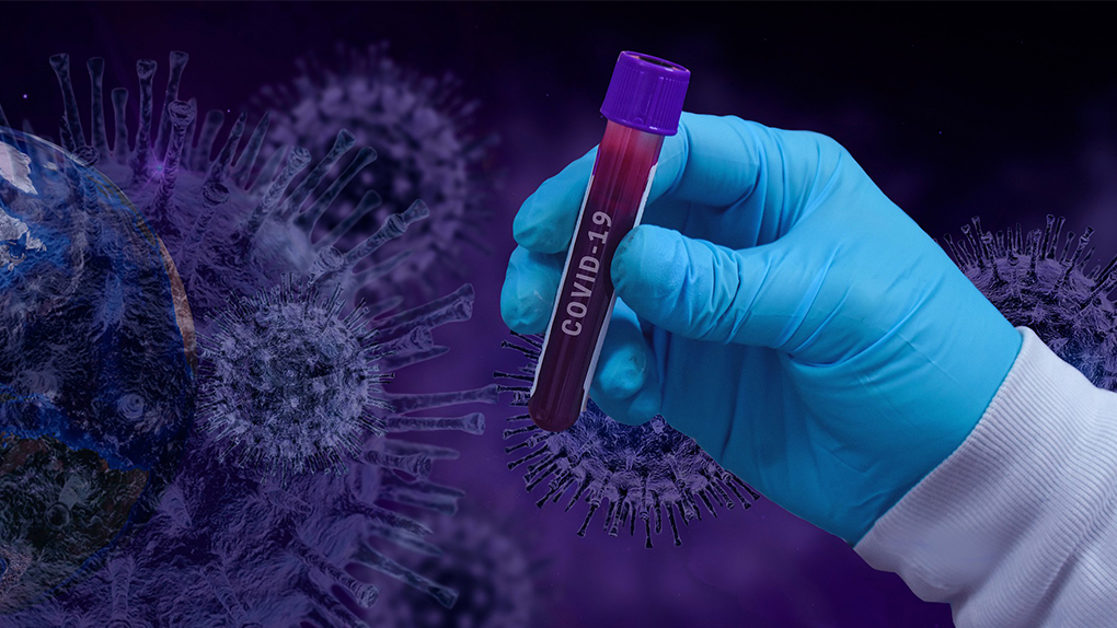 Une étude australienne indique que le coronavirus peut survivre 28 jours sur certaines surfaces