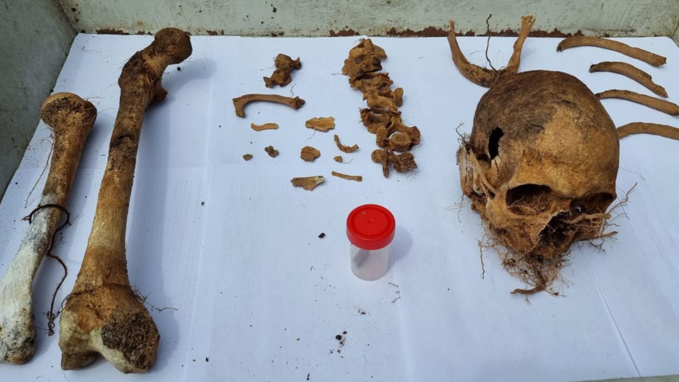 Ossements découverts à Salazie : Il s'agit d'un homme de plus de 40 ans