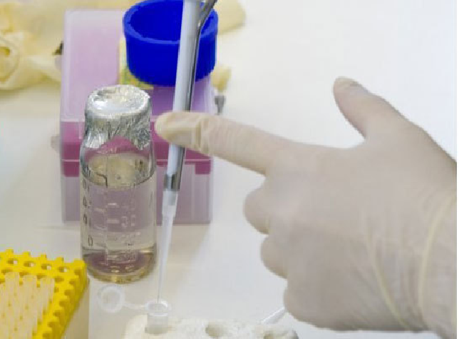 Bientôt un test urinaire pour détecter le cancer du col de l'utérus