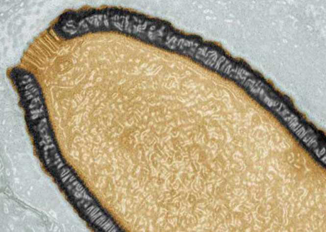 Découverte d'un virus géant de la famille de la variole en Sibérie dans les sols gelés