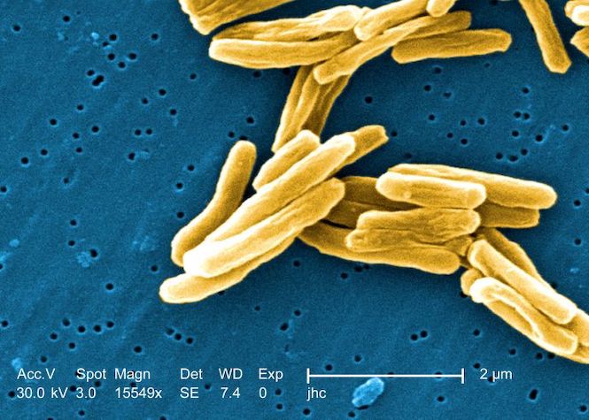 Le bacille de Koch, germe responsable de la tuberculose