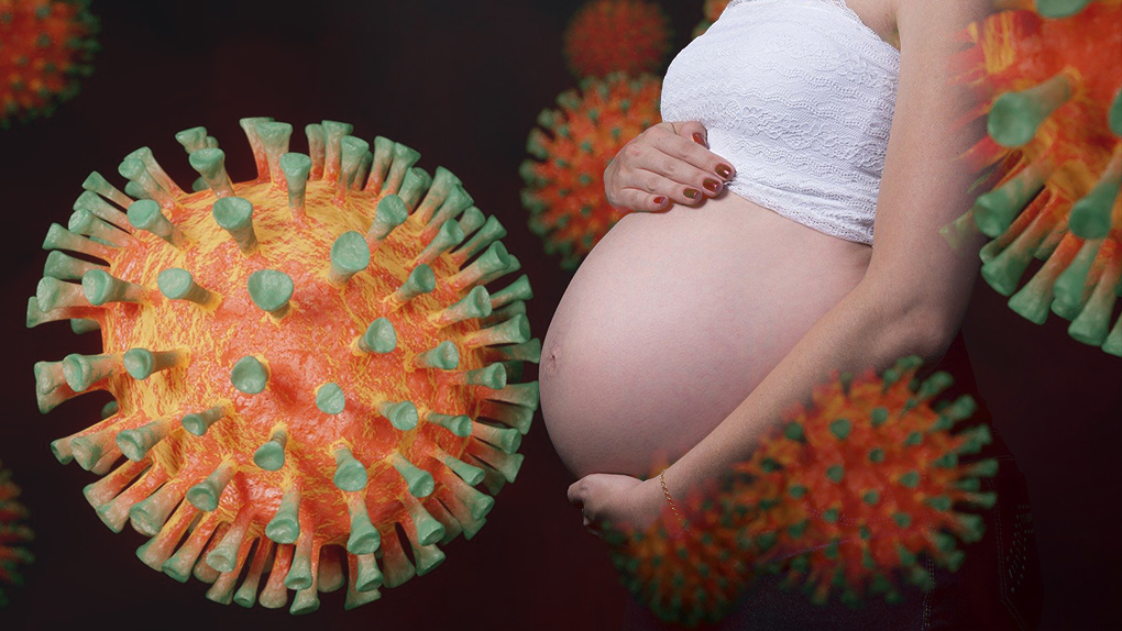 Coronavirus à La Réunion : Suivi des femmes enceintes