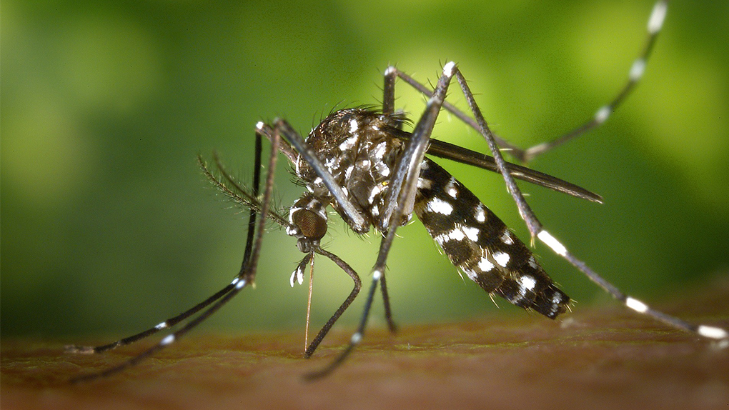 La combinaison des virus Zika et Chikungunya provoque des AVC
