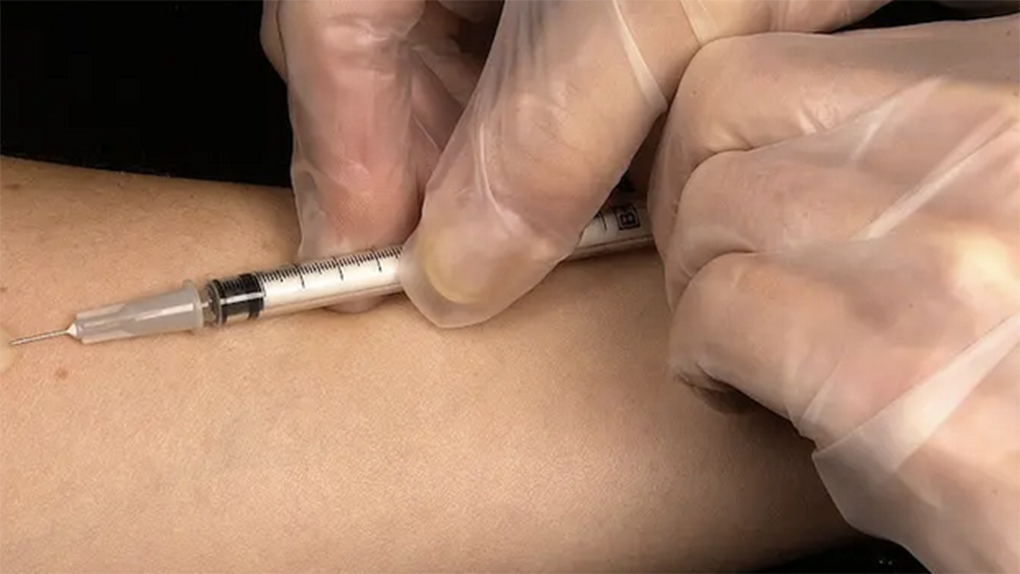 ​Covid-19 : Les adolescents pourraient avoir accès aux vaccins courant juin