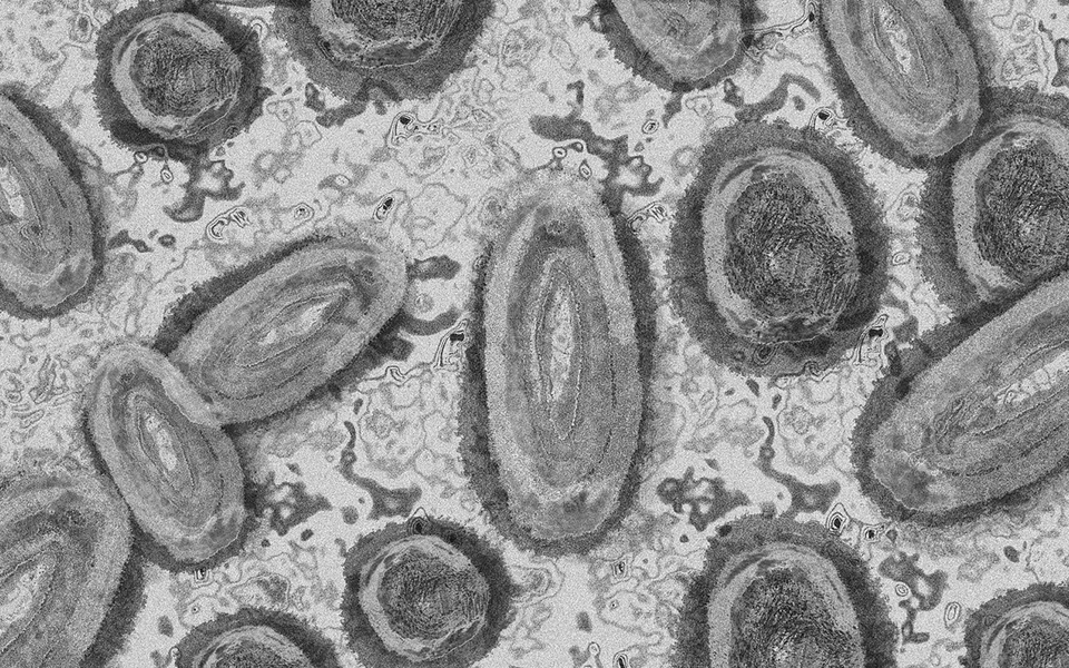 Comment reconnaître une contamination à la variole du singe ?