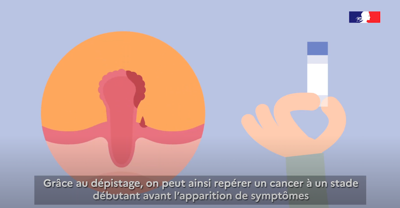 Capture d'écran Youtube Institut national du cancer