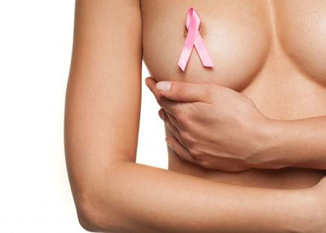 Le dépistage du cancer du sein remboursé à 100% pour les femmes ayant un "risque élevé"