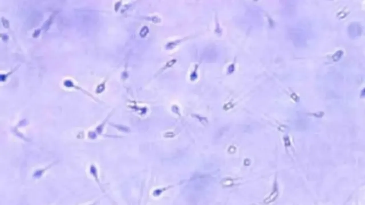 spermatozoïdes