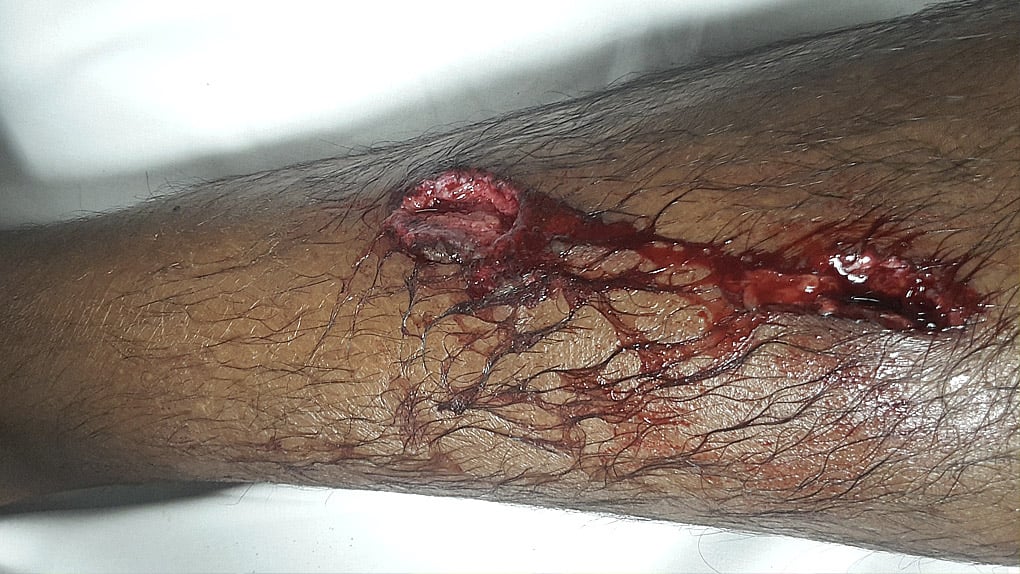 ? La Possession : Blessé par une grenade assourdissante, il témoigne