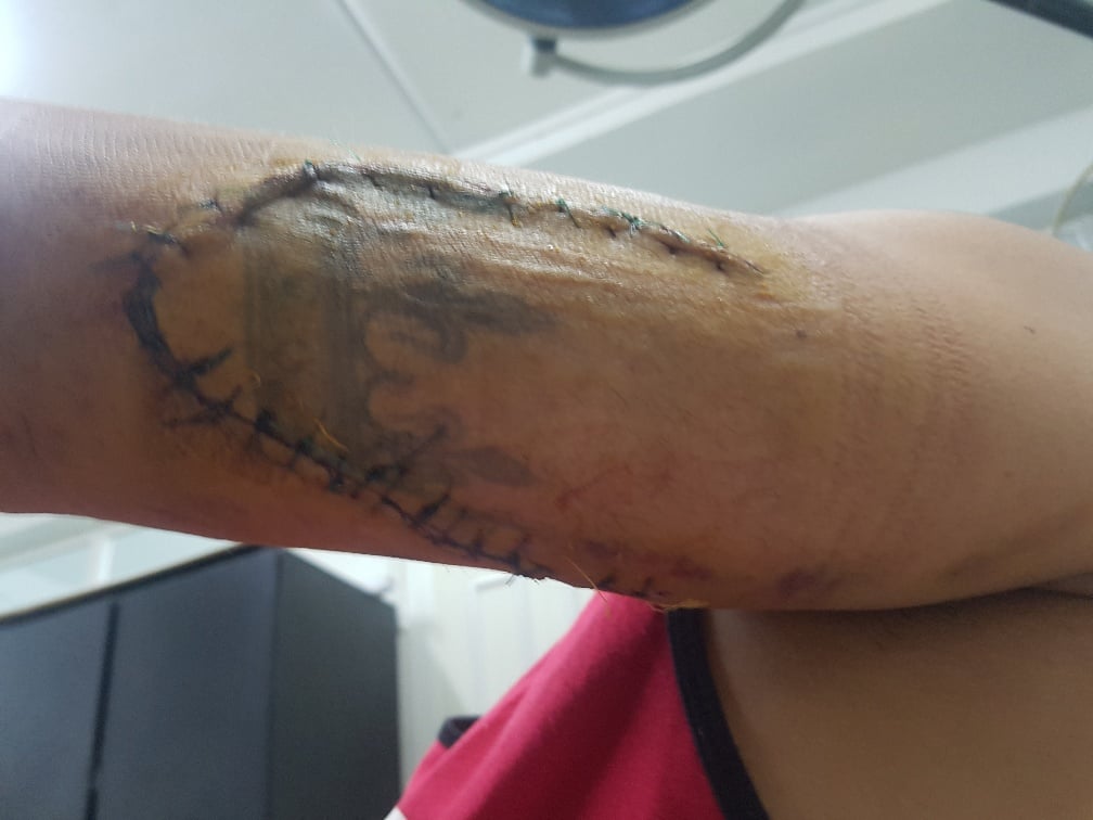 Tentative d’assassinat sur un touriste réunionnais à l’île Maurice