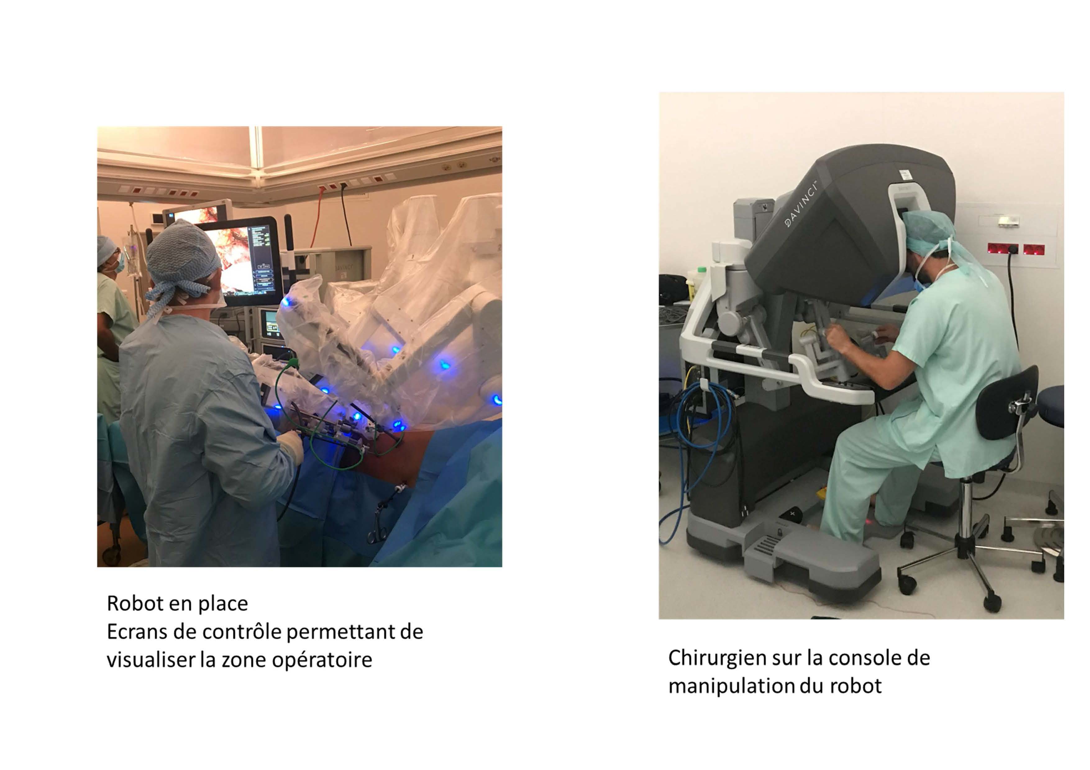 Les robots chirurgicaux au service des Réunionnais depuis un an