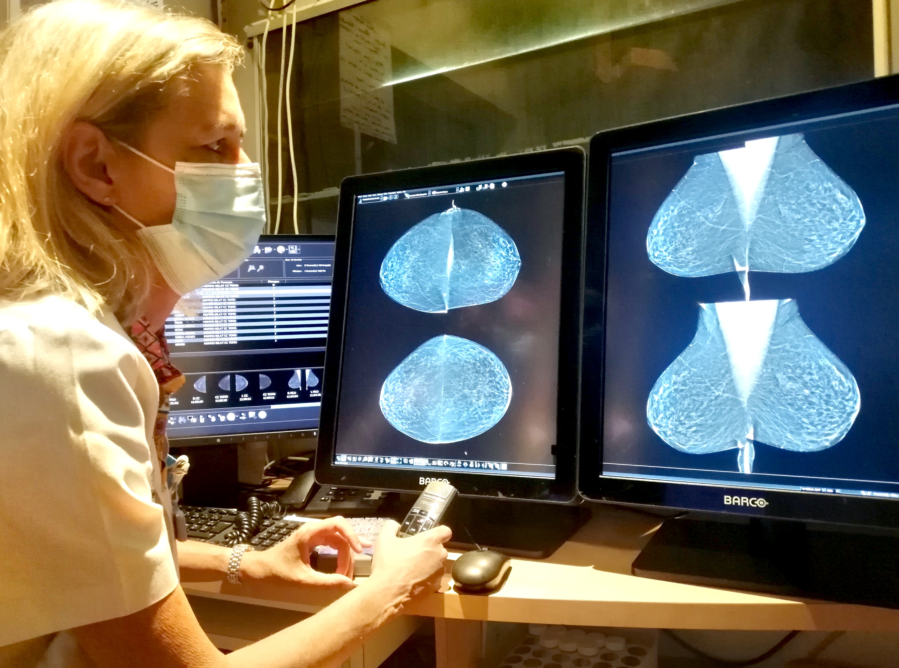 Le dépistage du cancer : si méconnu, mais pourtant si crucial