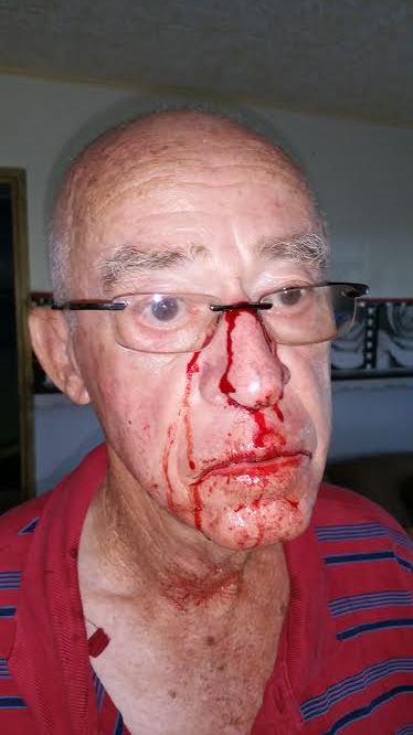 L'ancien conseiller général Rico Florian, 74 ans, agressé par un candidat