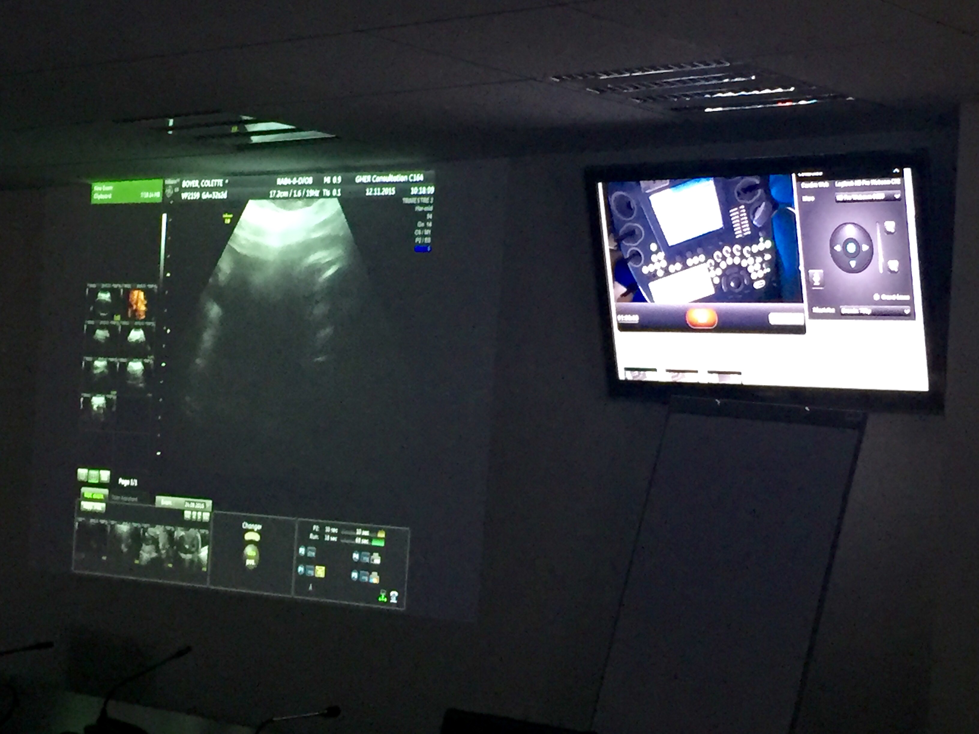 Formation Echo 3D 4D au GHER
